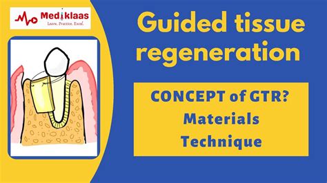 gtr tissue regeneration.